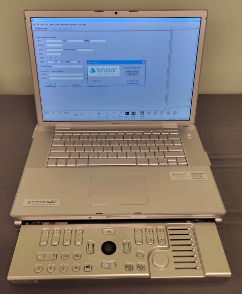 Terason Echo Ultrasound System with Terason 12L5-V & 4V2-S Probes