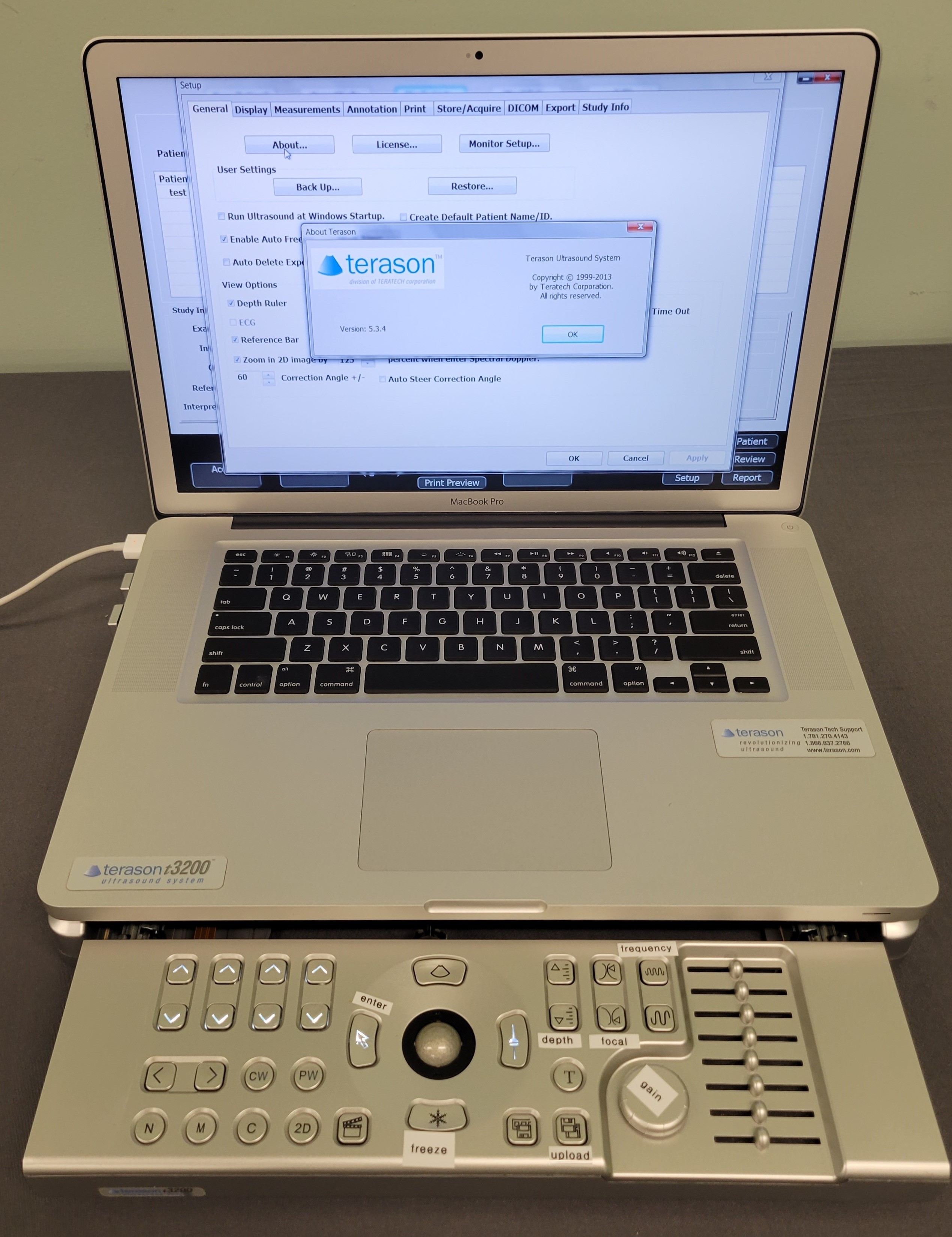 Terason t3200 Apple MacBook Pro Ultrasound System